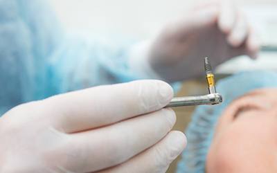 Close-up of dentist holding dental implant in Wayland, MA during surgery