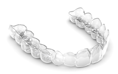 Close-up of Invisalign clear aligner