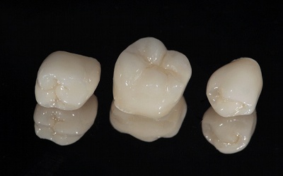 Dental crowns in Wayland resting on a table