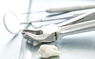 An extracted tooth resting next to dental instruments.