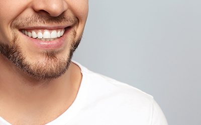 closeup of man’s smile after getting veneers in Wayland